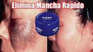 Mezcla La Crema Nivea Con Esto Dos Ingredientes Y Dile A Dios A la Mancha De Nuestra Piel [upl. by Byrdie564]