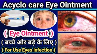 Acyclo care eye Ointment  Aciclovir Ointment use for eye infection kids amp Adult  Full Review [upl. by Nylarahs]