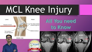 MCL Knee Injury and Treatment English Medial Collateral Ligament [upl. by Allimac]