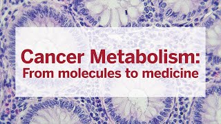 Cancer Metabolism From molecules to medicine [upl. by Niamjneb]