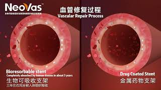 NeoVas™ Sirolimuseluting Bioresorbable Coronary Stent System [upl. by Nigen468]