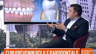 Laserul in tratarea bolii parodontale [upl. by Lopez]