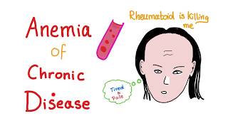 Anemia of Chronic Disease  Anemia of Inflammation All you need to know  Hematology Series [upl. by Tomasine]