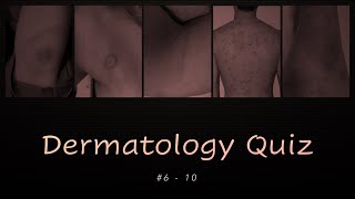 Dermatology Quiz 6  10 [upl. by Broucek448]