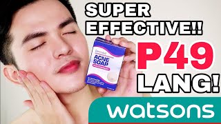 DermAid ACNE SOAP sa WATSONS Super Effective for PIMPLES [upl. by Diena326]