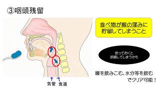 摂食・嚥下障害の基礎と誤嚥を防ぐ方法 [upl. by Htebaile]