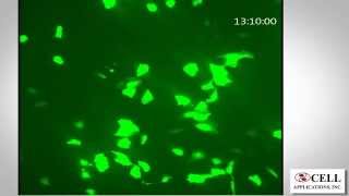 HUVEC Transfection Optimized with Cytofect™ Kit [upl. by Godbeare]