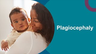 Plagiocephaly Positioning for your baby [upl. by Shayn]