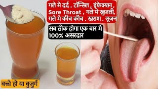 सिर्फ 5 मिनट गले में इंफेक्शन गले की हर तकलीफ से छुटकारा पाए Home Remedies For Sore Throat Tonsil [upl. by Carilla]