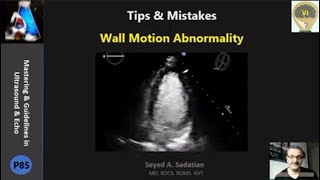 Tips amp Mistakes Wall Motion [upl. by Aihsoj]