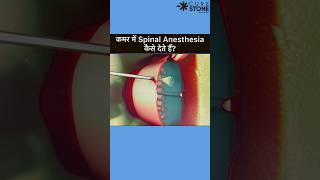 Spinal Anesthesia  How spinal is given  Epidural Anesthesia rirssurgery pregenency [upl. by Schwab97]