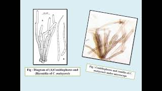 Cercospora leaf spot of okra prepared by Boyapati Ravi Teja Naidu and Rajat Kumar [upl. by Presber]