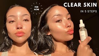 MY UPDATED SKINCARE ROUTINE  unsponsored skincare for acne [upl. by Niki]