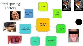 Obstructive Sleep Apnea for beginners [upl. by Ahtinak862]