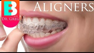 Things to Know Before Invisalign  Clear Aligner Therapy [upl. by Yelekreb]