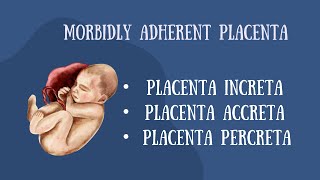 MORBIDLY ATTACHED PLACENTAPLACENTA INRCETAPLACENTA PERCRETAACCRETA [upl. by Yelsnia]