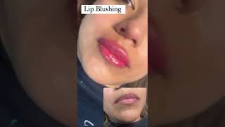 Hyaluron Pen lipfiller lips beauty skincare lipgloss aesthetic [upl. by Eelaroc]