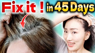 How to Stop Hair Loss and Regrow Hair Color Naturally with Scalp Lymphatic Drainage Massage [upl. by Atronna]