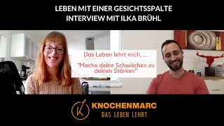 Leben mit einer Gesichtsspalte  Interview mit Ilka Brühl [upl. by Sapowith855]