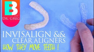 How Invisalign Works  How Clear Aligners Work [upl. by Leugar]