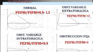 Patrones espirometricos  interpretacion [upl. by Aninahs633]