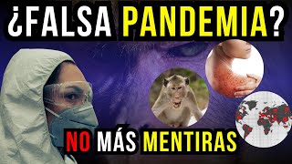 ¿Estamos Frente a una Nueva Pandemia Todo sobre la viruela del mono bienestar alerta [upl. by Siladnerb]