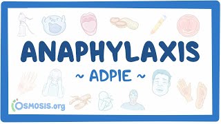 Anaphylaxis Nursing Process ADPIE [upl. by Ulland]