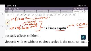 Dermatology  fungal infection  شرح العدوى الفطريه جزء من كورس الجلديه [upl. by Mur]