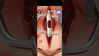 face treatment women youtubeshorts youtube youtuber doctor gaming gameplay [upl. by Crompton734]