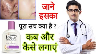 Lacto Calamine face lotion HONEST Review 2024 in hindi  Results Benefits Uses Price Information [upl. by Alphonsine111]