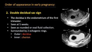 Ultrasound of normal early pregnancy [upl. by Salema]