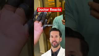 ER Doctor REACTS to quotDead Fingersquot [upl. by Bore]