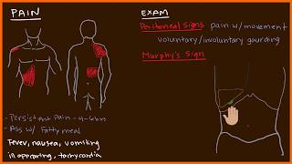 Acute Cholecystitis 23 [upl. by Murton710]