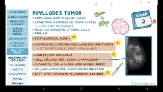 Benign breast conditions  pathology review  Osmosis [upl. by Colvin890]