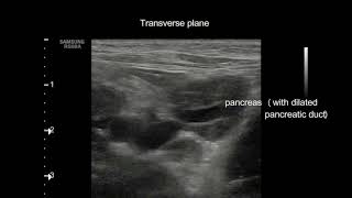 Extrahepatic cholestasis in a cat [upl. by Remark]