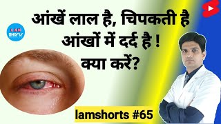 आंखें लाल है चिपकती है दर्द है  क्या करें Shorts lamshorts [upl. by Clifton]