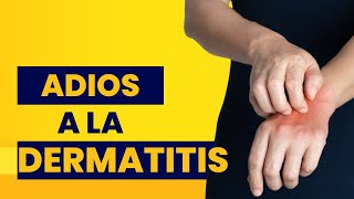 como curar la dermatitis en las manos  remedios caseros para la dermatitis en las manos [upl. by Alaek373]