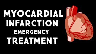 Myocardial Infarction MIHeart Attack Treatment in Emergency  Step wise STEMI Management USMLE [upl. by Modeste]