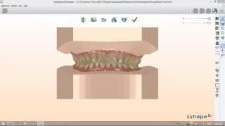 How to Prepare Orthodontic Models Set Virtual Models Bases [upl. by Yrian]