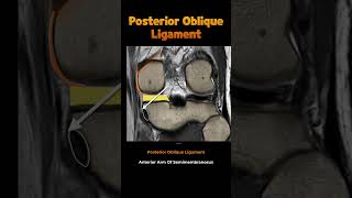 Fig 1A15 Additional peripheral attachments to the MM [upl. by Gitt]