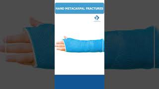 fractureseries  HAND PHALANX FRACTURES BYDr Vamshis Orthopaedic  Doctor role [upl. by Silvio]