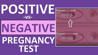 Pregnancy Test Positive vs Negative Results Time Lapse [upl. by Sarazen]