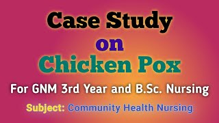 Case Study on Chicken Pox  Community Health Nursing  CHNII  GNM 3rd Year  BSc Nursing 4th Yr [upl. by Trebron]