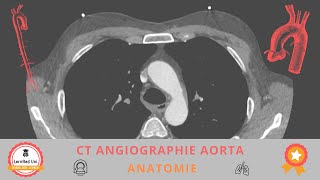 📌 Anatomie in der CT Angiographie der thorakalen und abdominellen Aorta [upl. by Keeley]