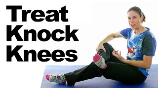 Treat Knock Knees with Easy Stretches amp Exercises [upl. by Yddeg]