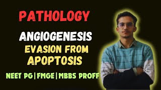 Neoplasia  Angiogenesis  Evasion From Apoptosis  Lecture 8  Neet pg  Fmge  Mbbs proff  Next [upl. by Bride756]