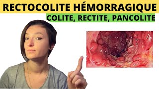 Rectocolite hémorragique Causes Symptômes Solutions naturelles [upl. by Sanjiv]