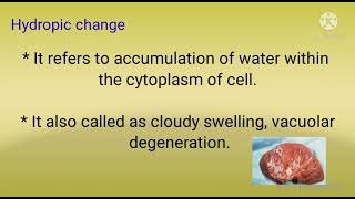 Hydropic change pathology  morphology of reversible cell injury part1 [upl. by Bili727]