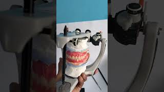 prostodoncia total protesisdental dentist dentalclinic [upl. by Ajak505]