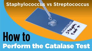 How to Perform the Catalase Test  Staphylococcus vs Streptococcus [upl. by Bunns344]